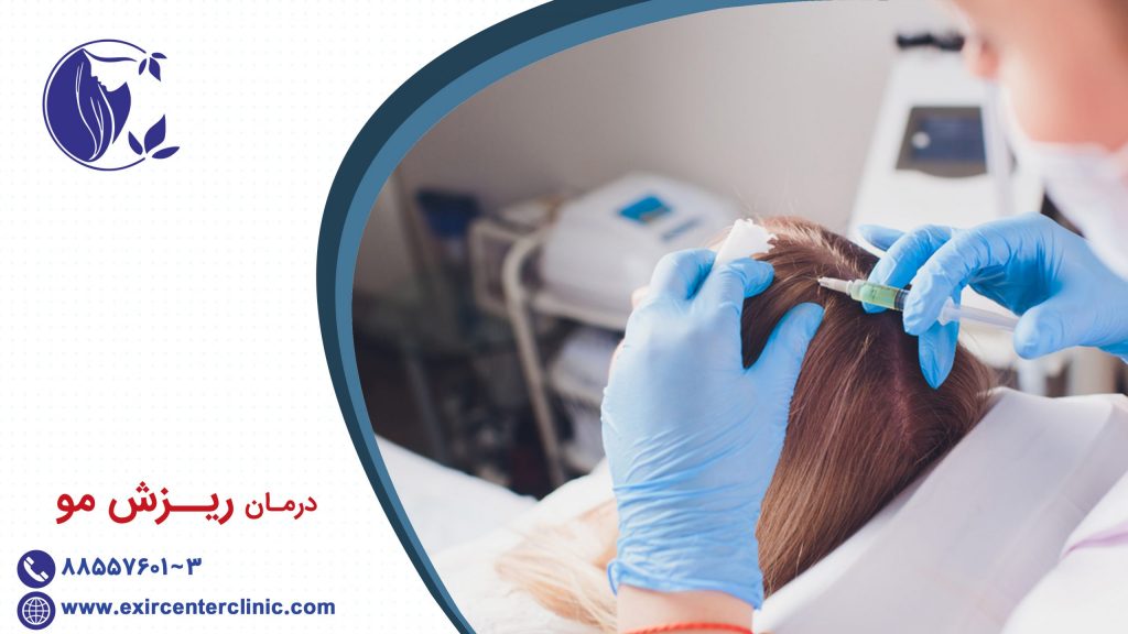 درمان ریزش مو 