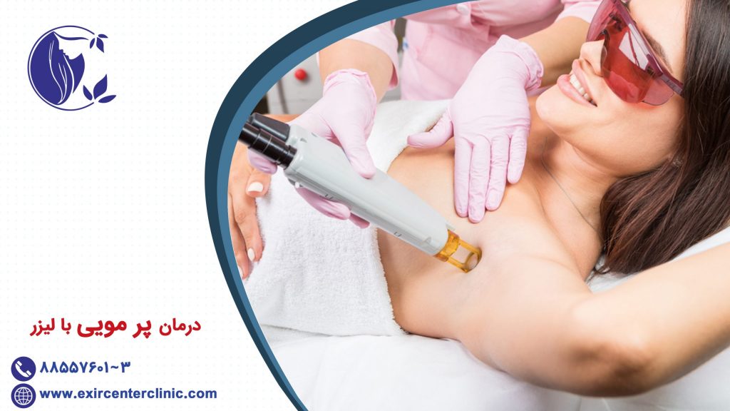 درمان پر مویی با لیزر