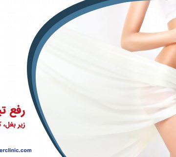 رفع تیرگی زیر بغل، کشاله ران و واژن