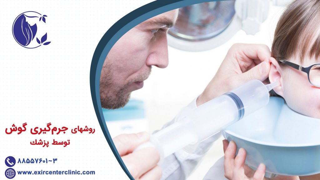 روشهای جرم‌گیری گوش توسط پزشك