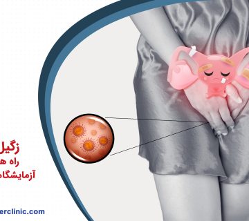 زگیل تناسلی و راه هاي تشخيص آزمايشگاهي آن در خانمها