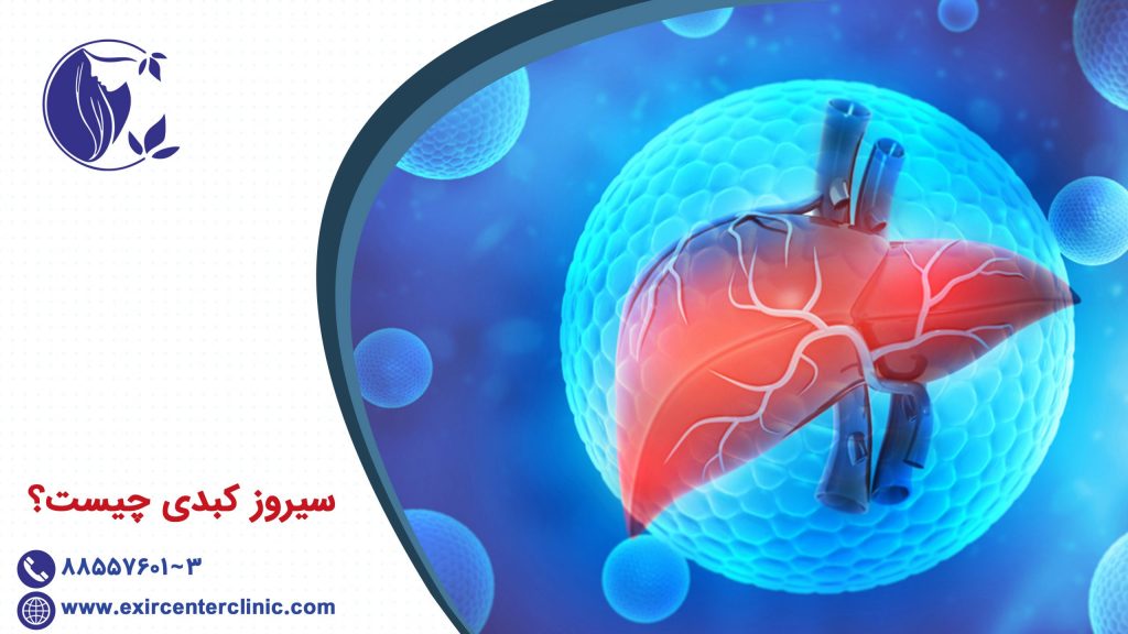 سیروز کبدی چیست؟