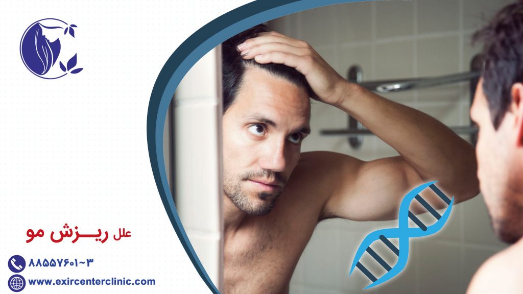 علل ریزش مو 