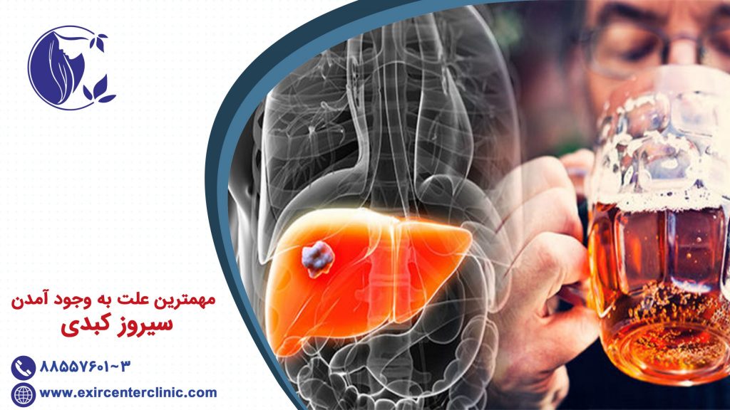مهمترین علت سیروز
