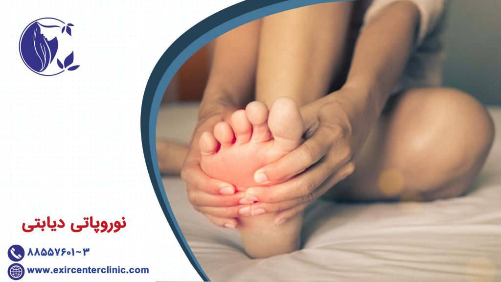 نوروپاتی دیابتی