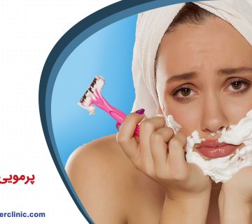 پرمویی در خانم ها