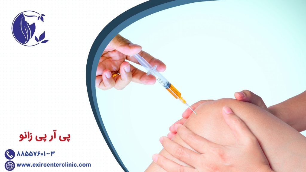 پی آر پی زانو