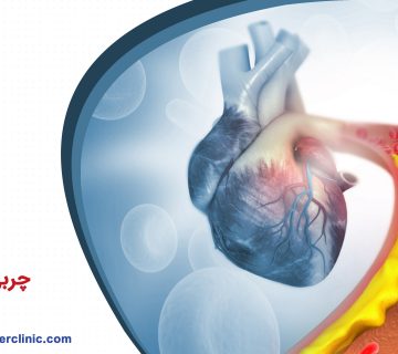 چربی خون بالا