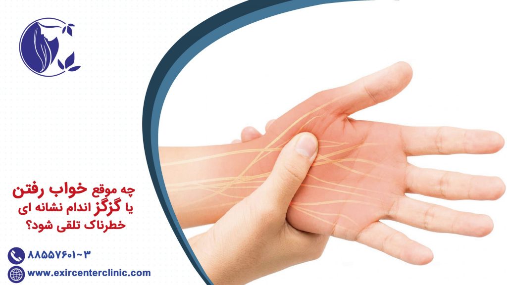 چه موقع خواب ‌رفتن یا گزگز اندام نشانه ‌ای خطرناک تلقی شود؟