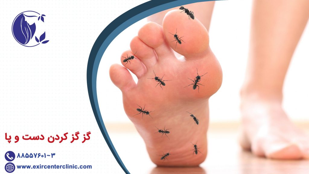 گز گز کردن دست و پا