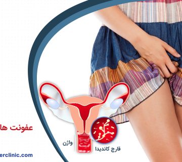 ﻋﻔﻮﻧﺖ ﻫﺎﯼ ﻗﺎﺭﭼﯽ بانوان