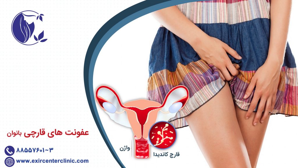 ﻋﻔﻮﻧﺖ ﻫﺎﯼ ﻗﺎﺭﭼﯽ بانوان