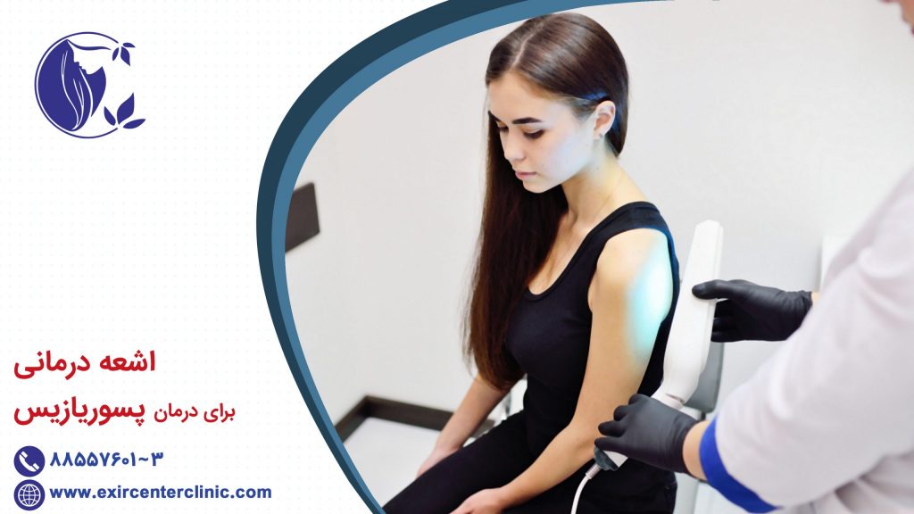 اشعه درمانی برای درمان پسوریازیس