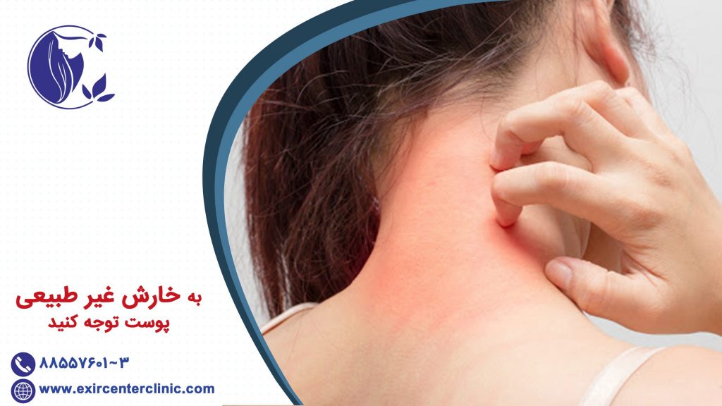 به خارش غیر طبیعی پوست توجه کنید