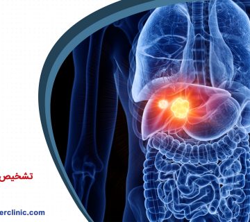 تشخیص سرطان کبد