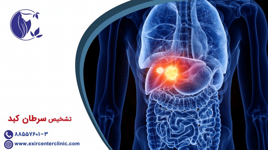 تشخیص سرطان کبد