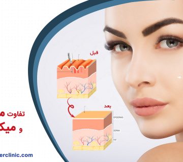 تفاوت میان میکرونیدلینگ و مزونیدلینگ