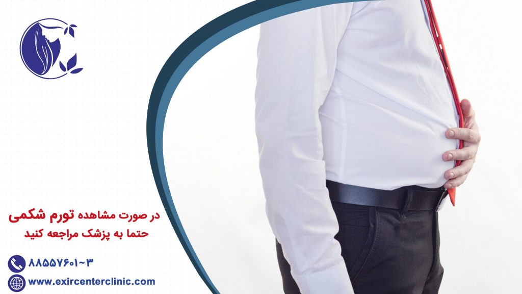 در صورت مشاهده تورم شکمی، حتما به پزشک مراجعه کنید