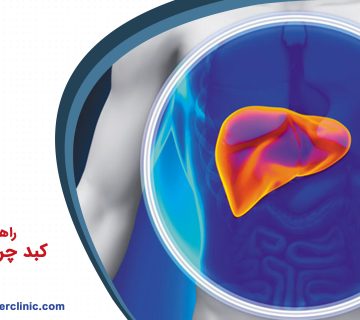 راهنمای جامع کبد چرب غیر الکلی
