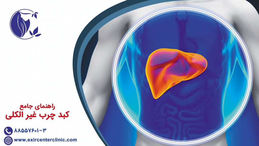 راهنمای جامع کبد چرب غیر الکلی