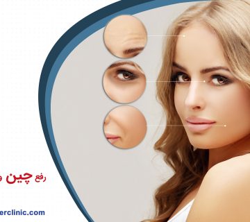 رفع چین و چروک صورت