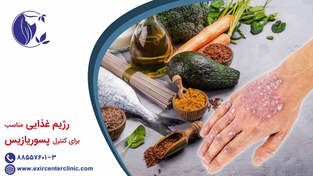 رژیم غذایی مناسب برای کنترل پسوریازیس