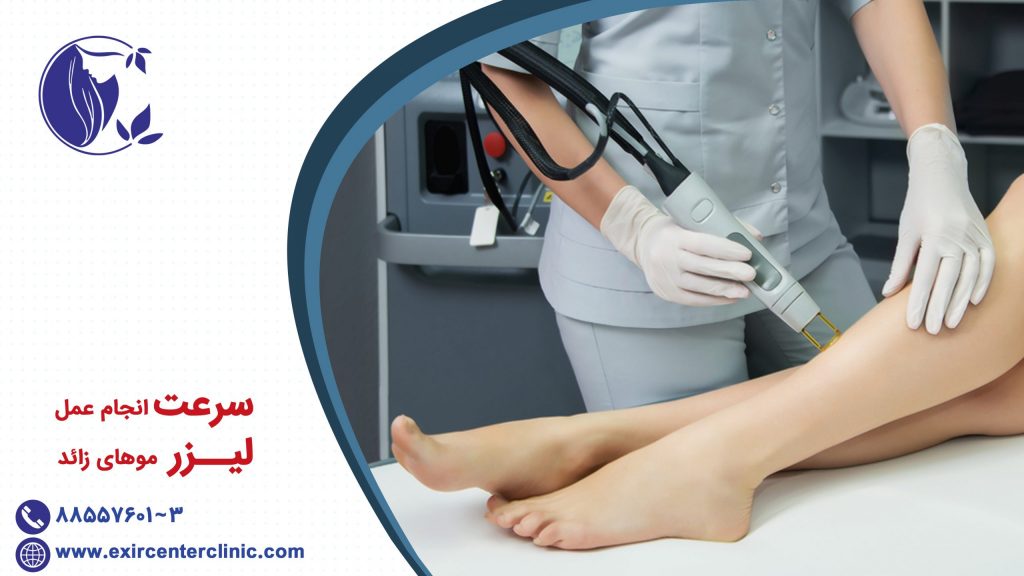 سرعت انجام عمل