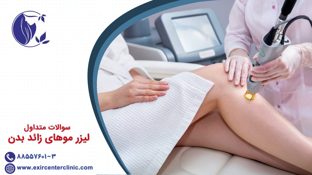 سوالات متداول لیزر موهای بدن