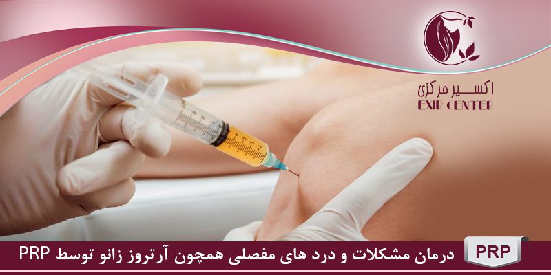 پی آر پی زانو