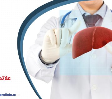 علائم سیروز کبد