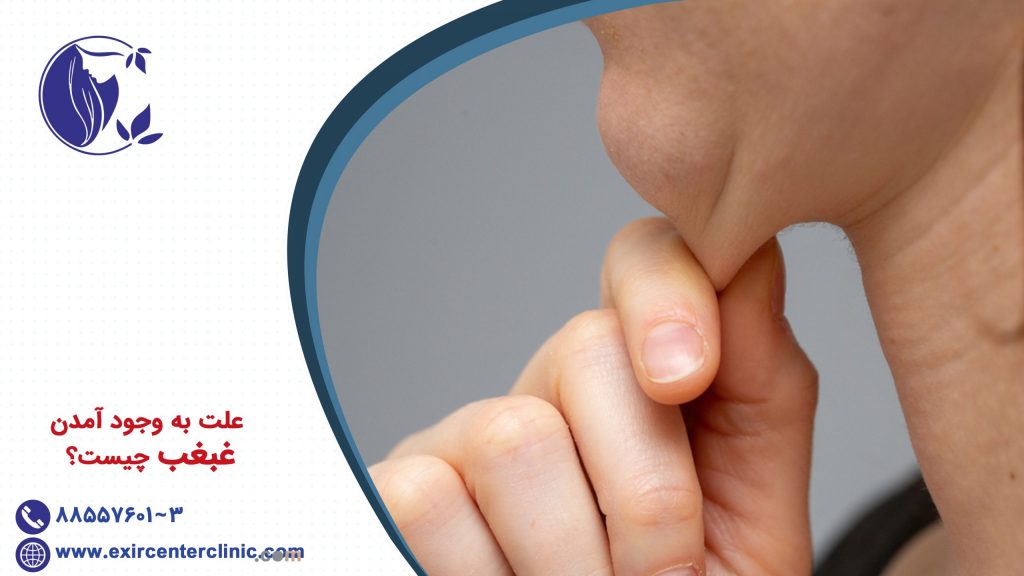 علت به وجود آمدن غبغب چیست؟