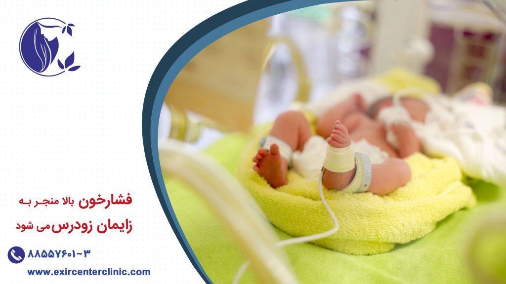 زایمان زودرس و فشارخون بالا