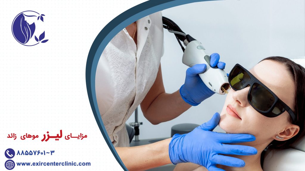 مزایای لیزر موهای زائد