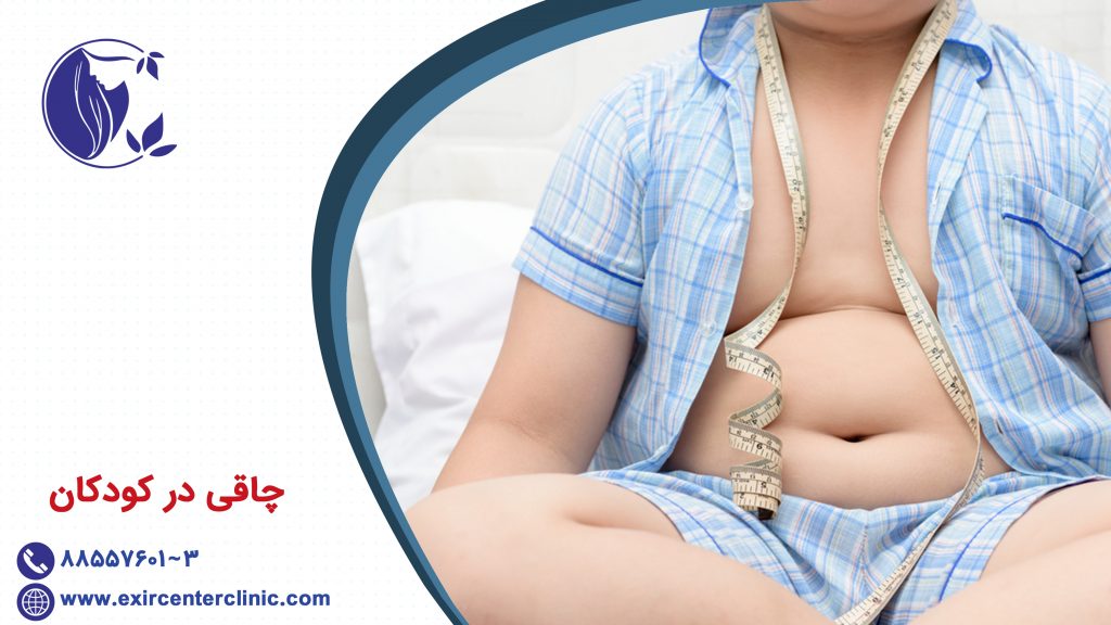 چاقی در کودکان