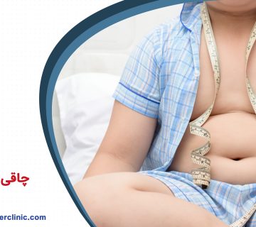 چاقی در کودکان