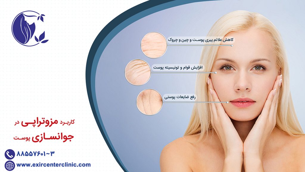 کاربرد مزوتراپی در جوانسازی پوست