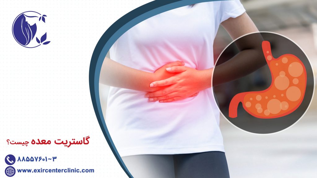 گاستریت معده چیست؟