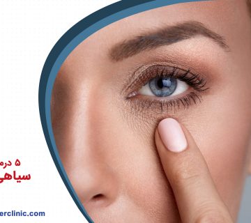 5 درمان مفید برای سیاهی دور چشم