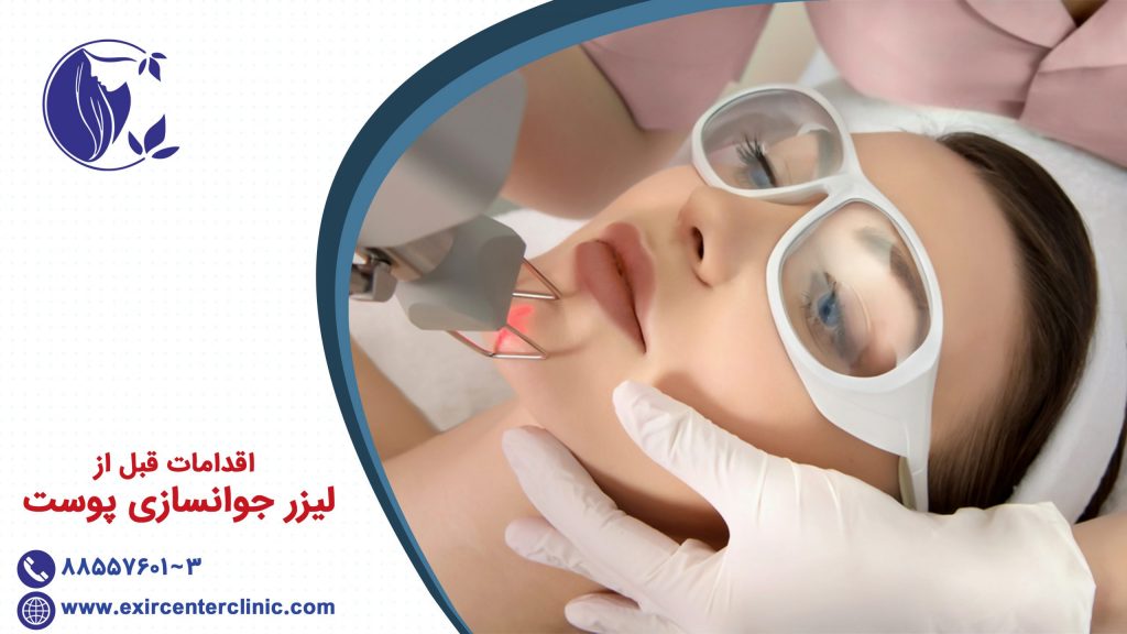 اقدامات قبل از لیزر جوانسازی
