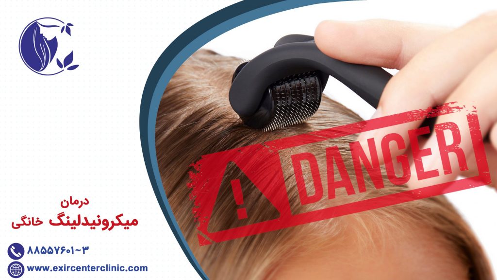 درمان میکرونیدلینگ خانگی