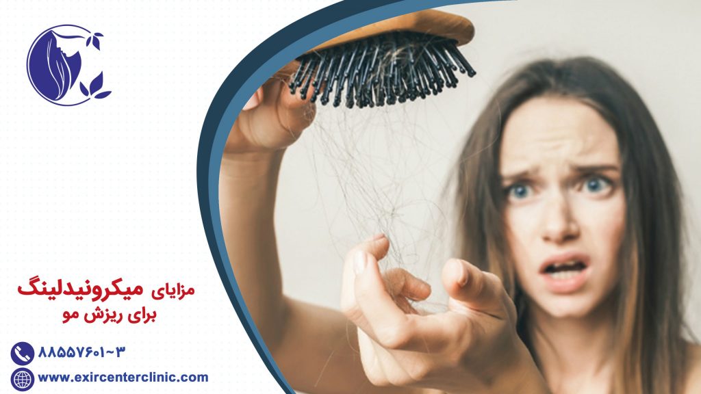 مزایای میکرونیدلینگ برای ریزش مو