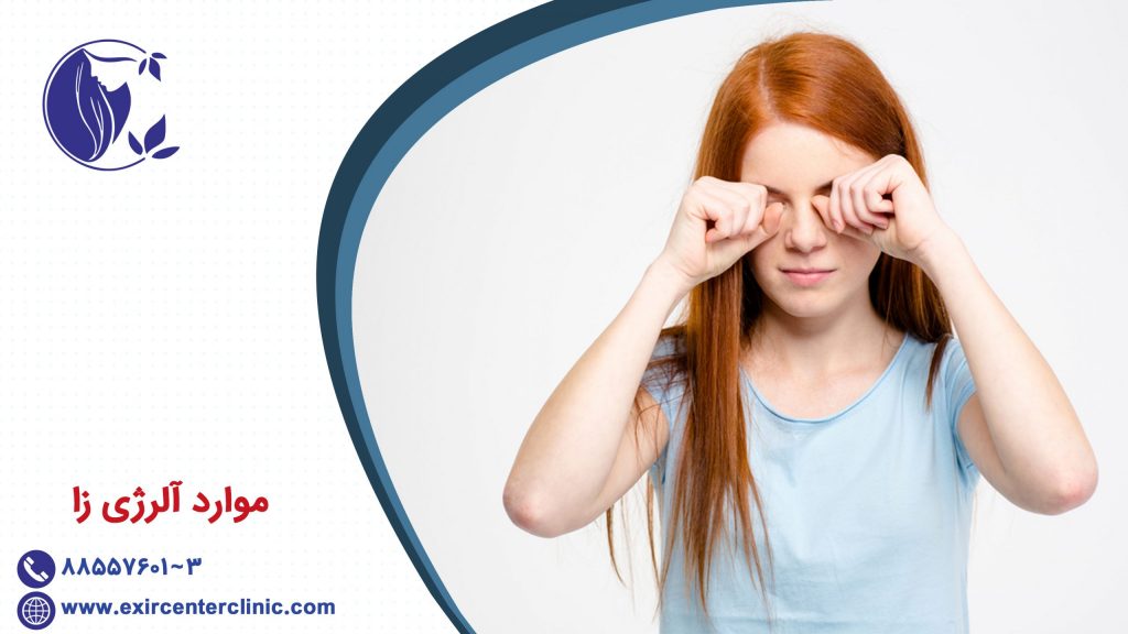 موارد آلرژی زا