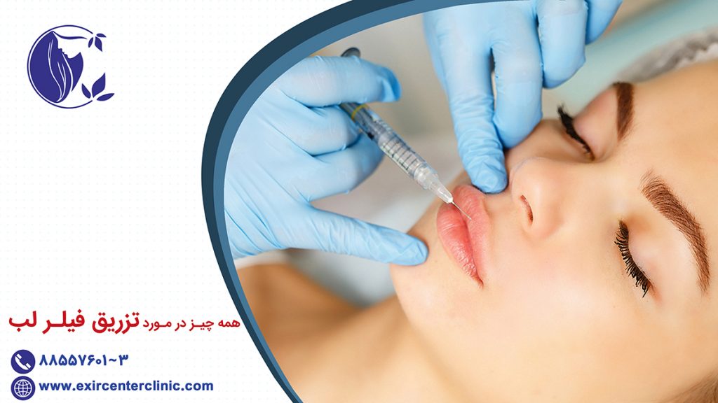 همه چیز در مورد فیلر لب