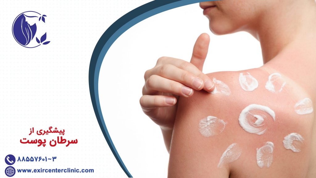 پیشگیری از سرطان پوست