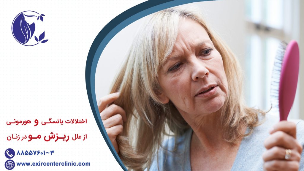 اختلالات یائسگی و هورمونی از علل ریزش مو
