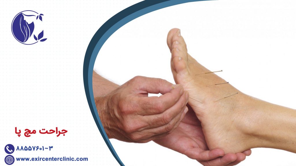 جراحت مچ پا