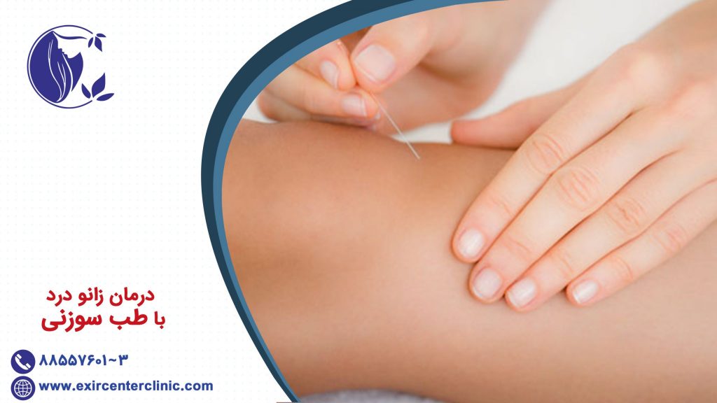 درمان زانو درد با طب سوزنی