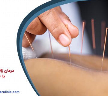 درمان زانو درد و مچ درد با طب سوزنی