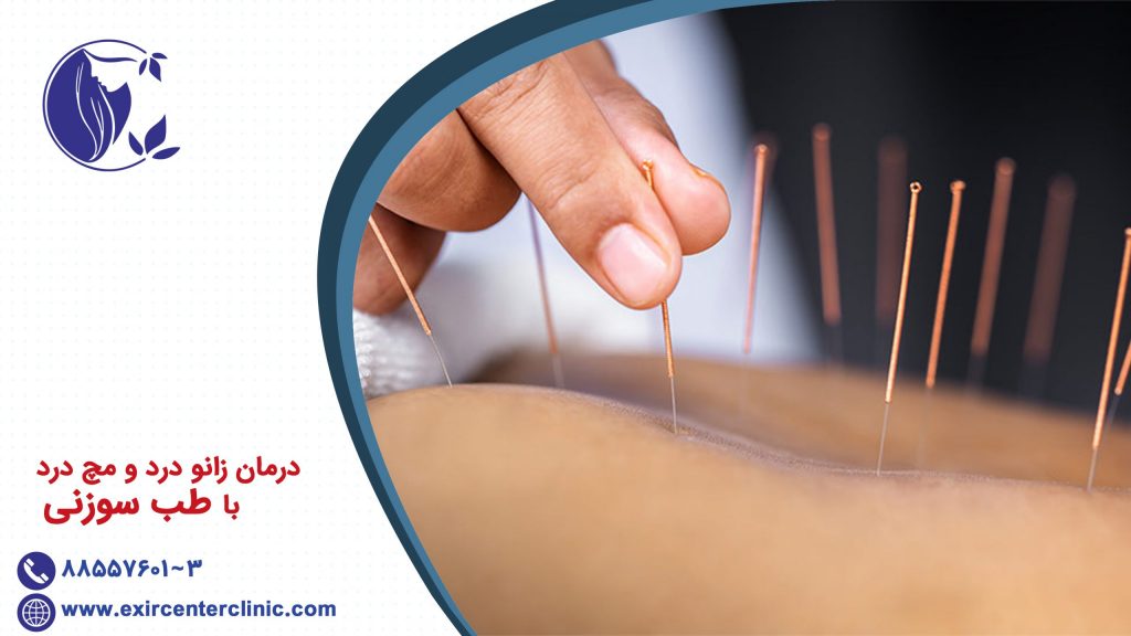 درمان زانو درد و مچ درد با طب سوزنی