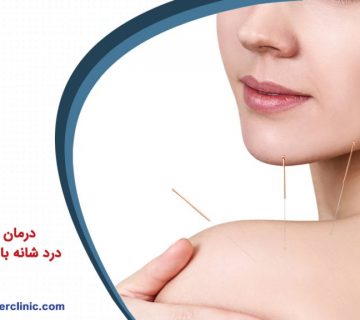 درمان گردن درد و درد شانه با طب سوزنی